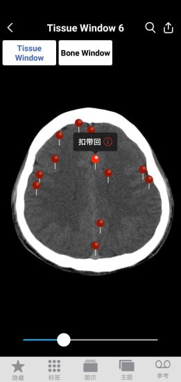 轻盈医学图谱全免费版 轻盈医学图谱全免费版