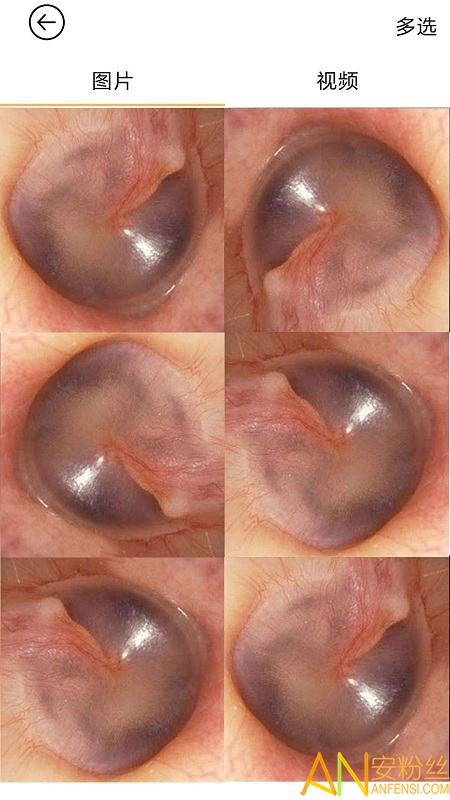 ����ɶ�app�ֻ���