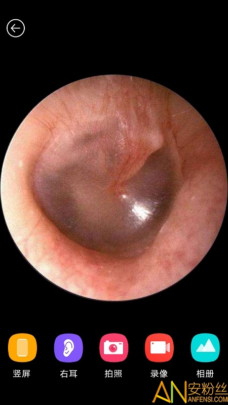 ����ɶ�app�ֻ���