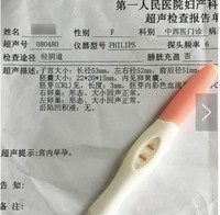 ���˽��м챨����������ô�� ���˽��м챨��-��׿��Ѷ�� title=