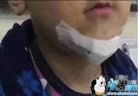 ģ�¶���Ū�˵ܵ���ģ����ʲô-����Ӧ�ñ�����