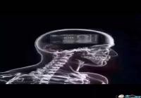 ����CT����ͼƬ-�����ܻ����CTͼ