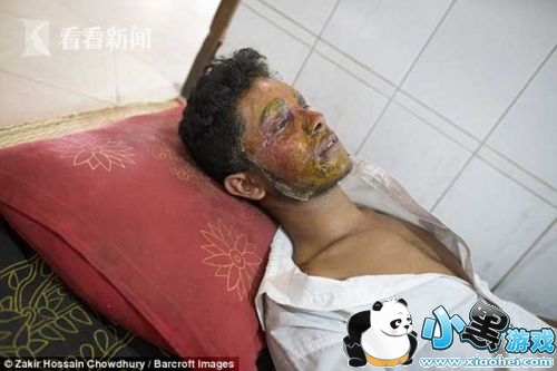 拒绝求爱遭泼硫酸是怎么回事 男子拒绝求爱遭泼硫酸被毁容了吗/对方被逮捕了吗 拒绝求爱遭泼硫酸是怎么回事 男子拒绝求爱遭泼硫酸被毁容了吗/对方被逮捕了吗