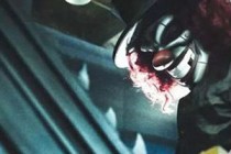 �����˸����籭�������ʲô ���籭�������÷�������